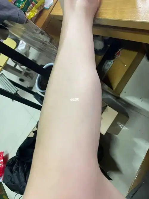 长得奇奇怪怪又不方又不圆,贼影响腿型,咋让他消啊#肌肉腿  #小腿肌肉