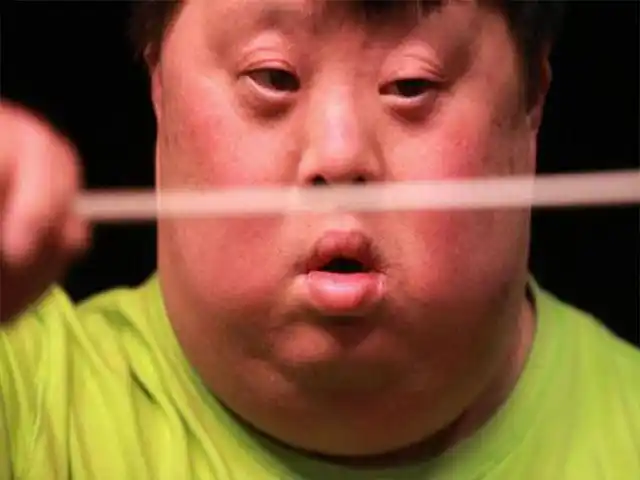 泰国全部需要花多少钱能做袖珍人试管婴儿 - 求医网