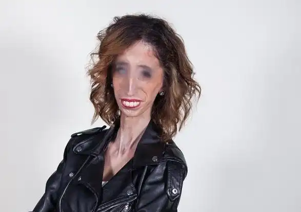 世界上最丑的女人丽兹维拉斯奎兹世界第一丑的美丽故事