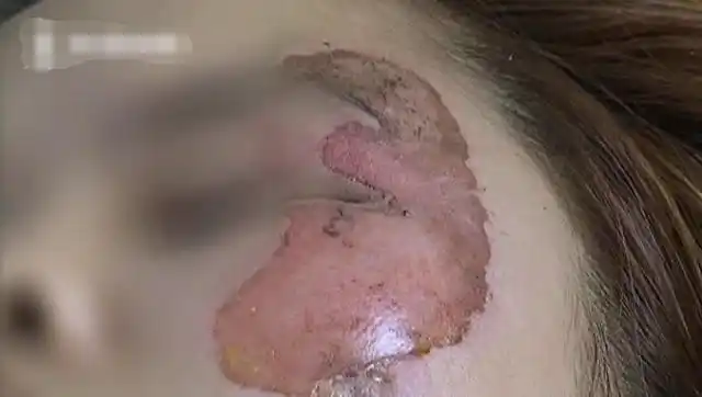 女子车祸被撞到在地多处被烫伤朋友在旁却未救扶