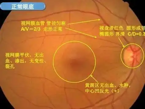 血管|黄斑|视网膜|玻璃体|脉络膜|视神经_网易订阅
