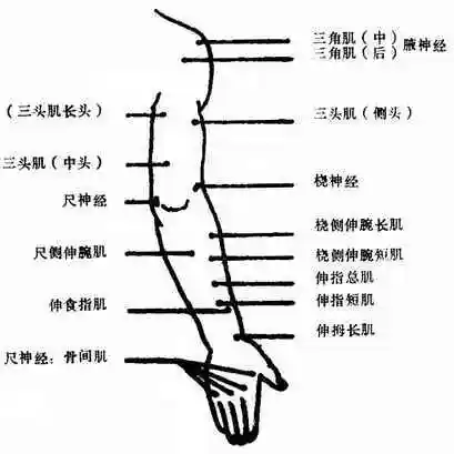附:电诊断(electrodiagnosis)