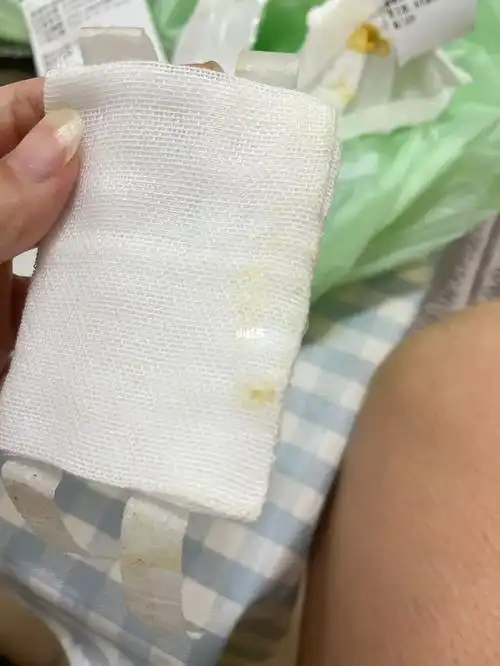 侧睡,还炒菜,然而自己换药的时候发现纱布有一点点米黄色的干的东西