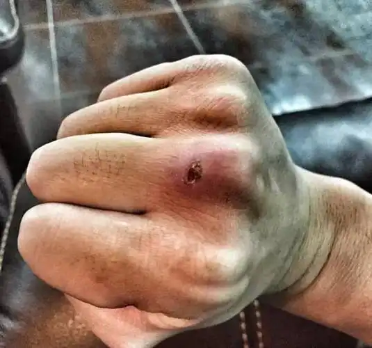 早劝你们要少撸铁你们不听看看这一个个的手啧啧