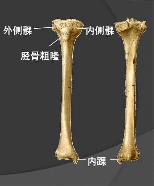 73胫骨粗隆(正面图)73髌腱护具2预防的途径介绍4种最简单有效的
