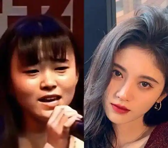 10位女星整容前后差距太大,最后一位网友们表示简直换了头_赵丽颖