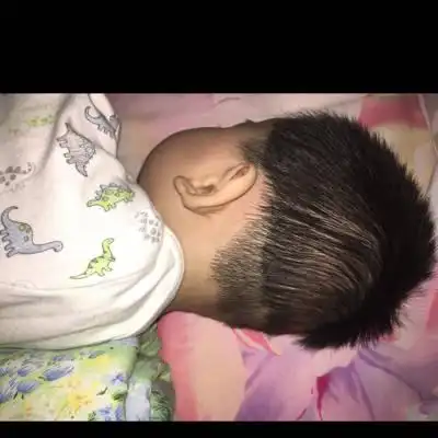 6个月宝宝后脑勺凹凸不平,怎麼办?