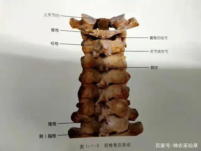 哎呀好痛,颈椎间盘突出究竟啥情况?带您一起了解下!