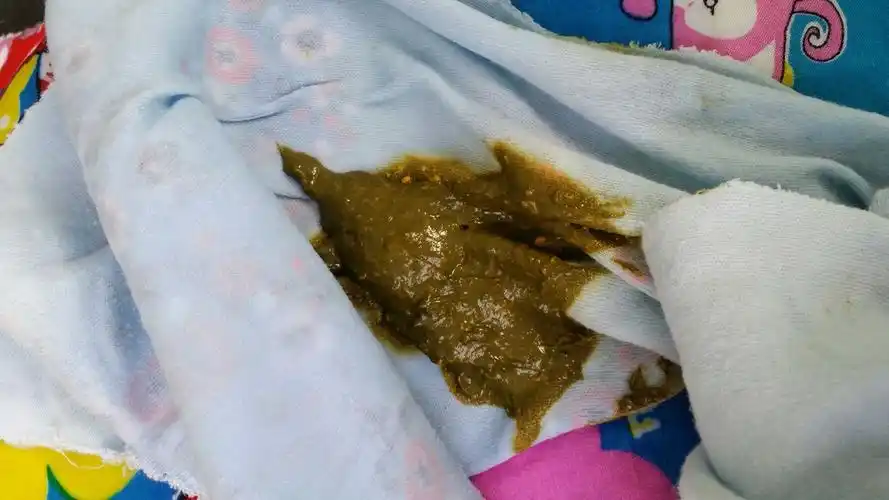 万能的妈妈帮,帮忙看一下我孩子拉的大便这是怎么了?八天了才拉.