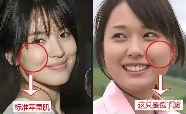 苹果肌还是高颧骨?99%的人都分不清