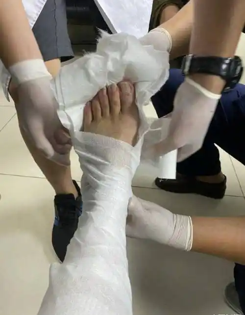 63岁潘长江带伤坚持工作,近照腿受伤状态却佳,不用替身好模范_网络