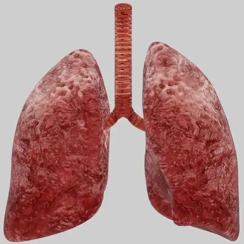 装配的人体肺部stl模型