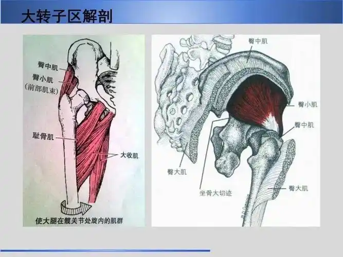股骨大转子疼痛综合征mr特征