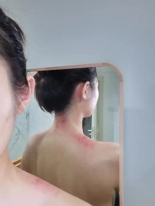 居家颈部刮痧俏妍津率享精油