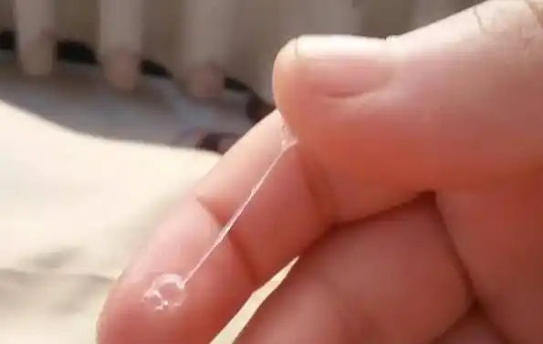 一般来说,阴道的分泌物也就是我们的白带是没有异味的,正常的白带是