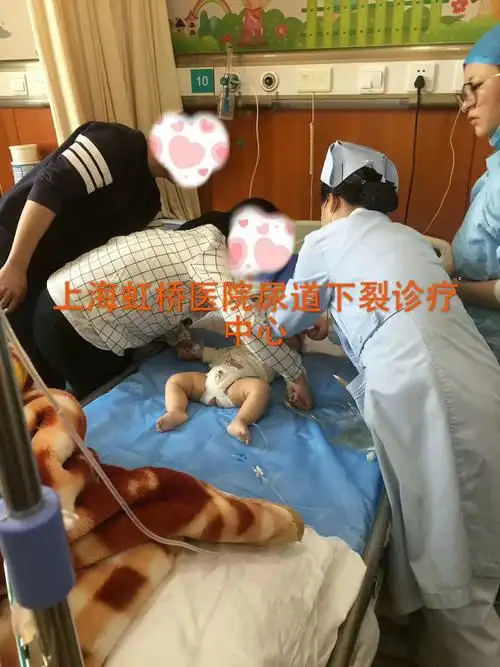 尿道下裂术后注意事项