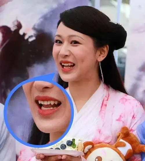 用演技俘获大批粉丝如今杨紫终于承认整了