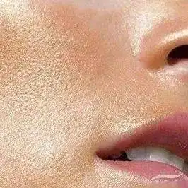 皮肤越熬越黄!到底应该怎么办?