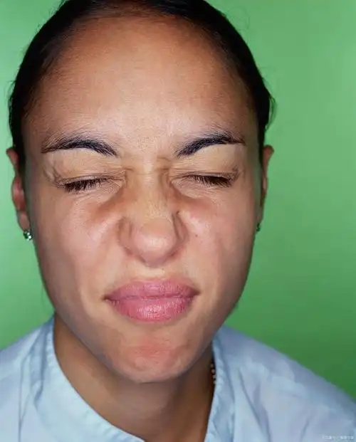 年轻人面瘫一般多久恢复?