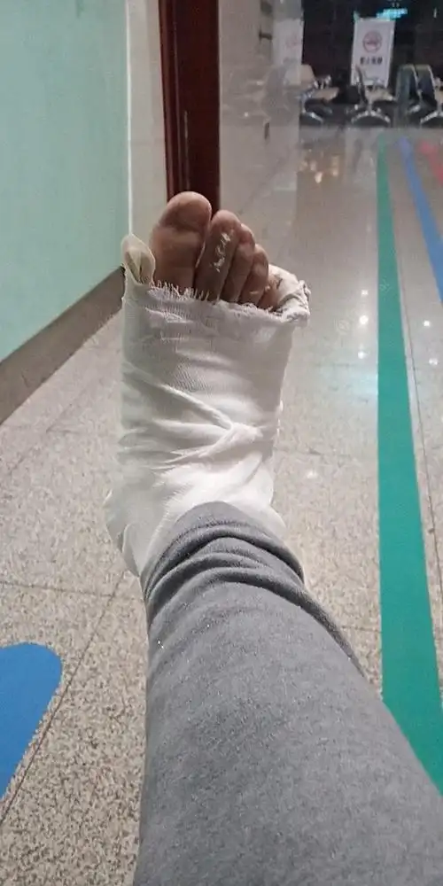 脚受伤了,什么也干不了