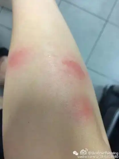 学名床虱,俗称臭虫,是一种很小及难以捕捉的寄生昆虫,属于臭虫科,是