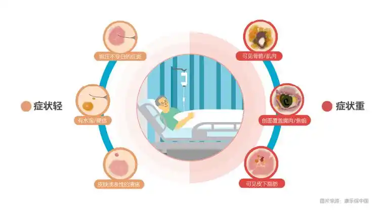 2023年世界压疮预防日皮肤安康即刻守护