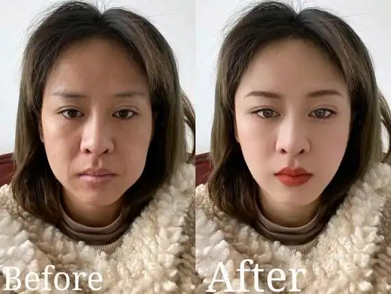 何时应该开始抗衰老?抗衰老应该做哪些项目?今天我们_圈子-新氧美容整