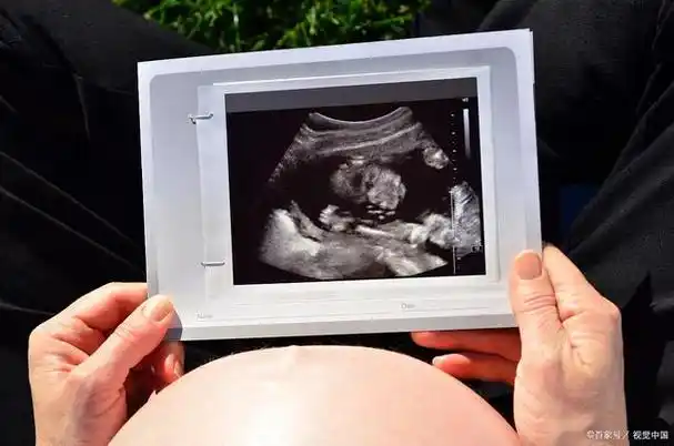 母婴育儿:孕妇为什么要做四维彩超?