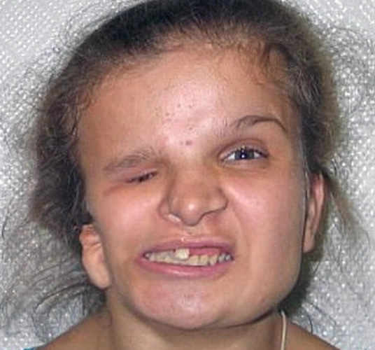 她从出生开始脸部就长得畸形,而且katya的亲生母亲竟然嫌弃她的长相