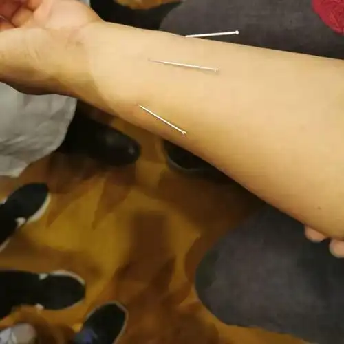 手麻的快速缓解方法 - 好大夫在线