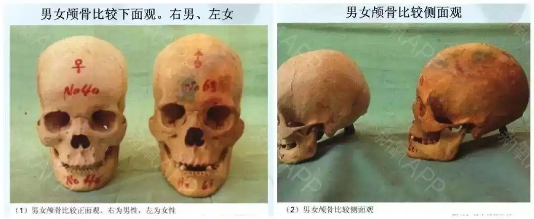 关于男女骨骼上的差异,以上只是很小的一部分,更细化的还有下颌骨.