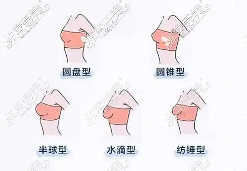 型,根据胸部形态,正常胸型可分为:圆盘型,圆锥型,半球型,水滴型,纺锤