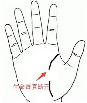 生命线断开代表什么