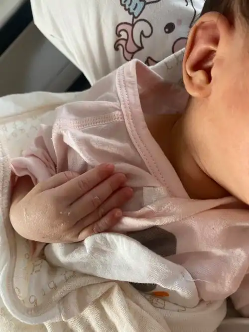 怎么办,喂奶喂的乳头都要破皮了,每次喂都是忍着巨疼_妈妈网孕育社区