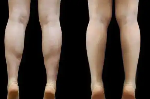 一兆韦德4个减掉大腿内侧赘肉的有效动作练出超模腿