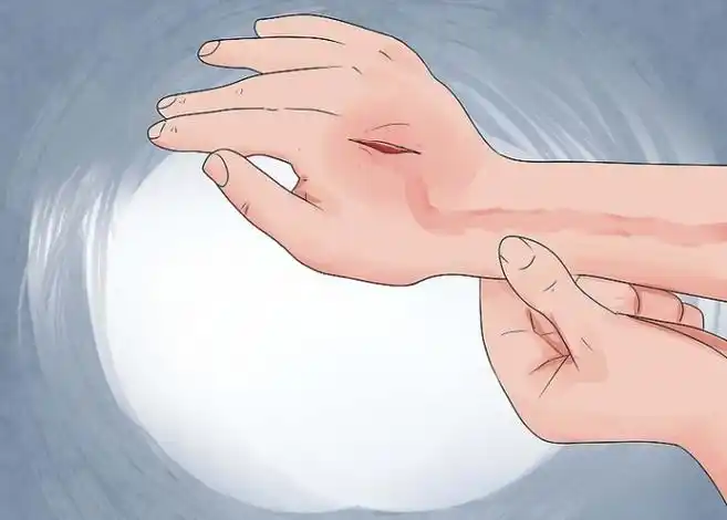 如何检查伤口是否感染