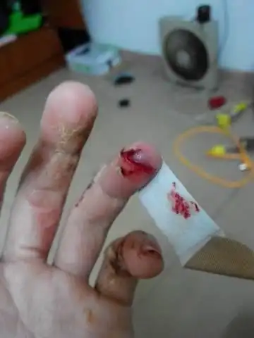 这种刀伤可以不缝吗?自己消毒下包扎下没问题吧