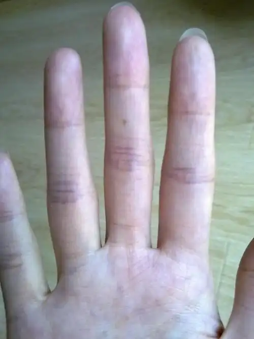 领证当天就长出来了,右手中指与无名指中间的痣是什么意思?