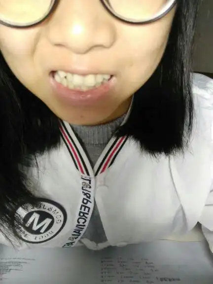 两颗门牙是兔牙,今年17,请问需要怎么矫正