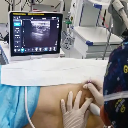 中国医科大学王赫教授带来新技术助力患者术后快速康复