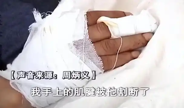 等到邻居赶来时,才制止了周新永,只是当时周炳义早已血流成河,但是