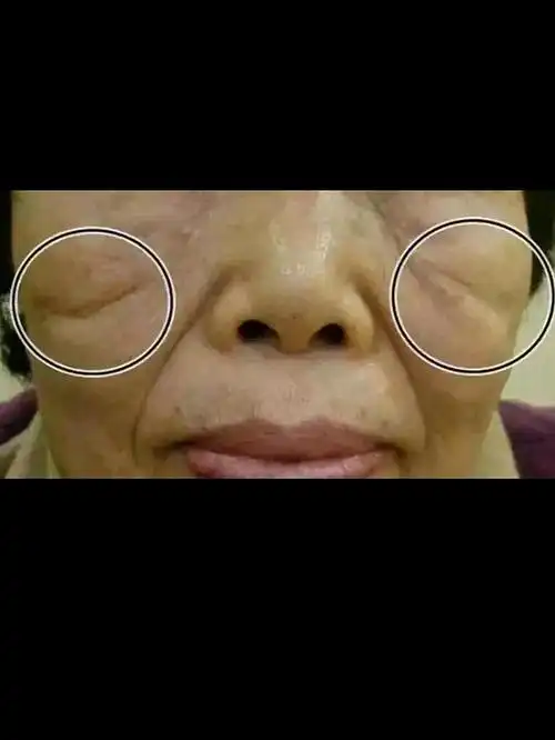 让少女变大妈的印第安纹,是填充还是提升?