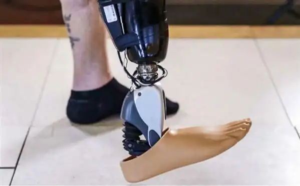 大脑控制仿生义肢问世