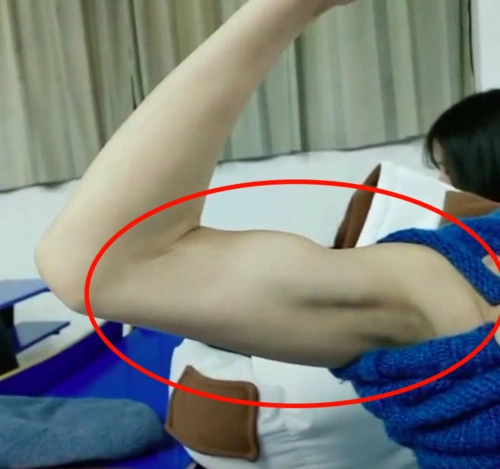 看到女同学秀出来的肱二头肌后,网友们纷纷表示:"别的女生,连瓶盖都