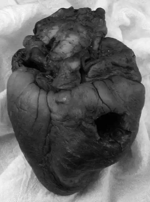 15张让你看了睡不着的恐怖照片 背后的故事太可怕