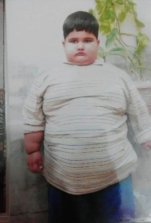 世界上最胖的小胖子图片,六个月大的时候体重就达到了23kg