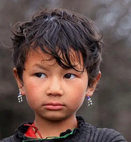 为什么会出现高原红