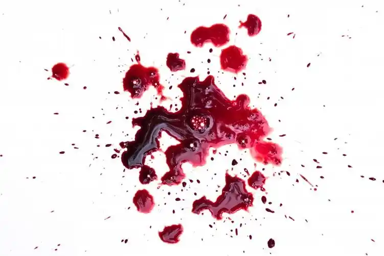 鲜红的血迹图片第5张