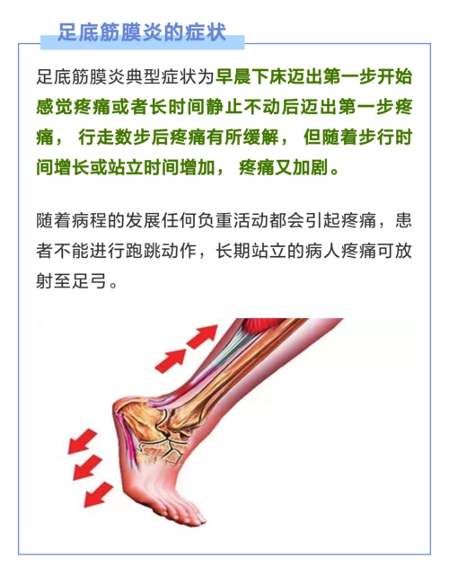 足跟疼痛～足底筋膜炎的一些简单疗法!