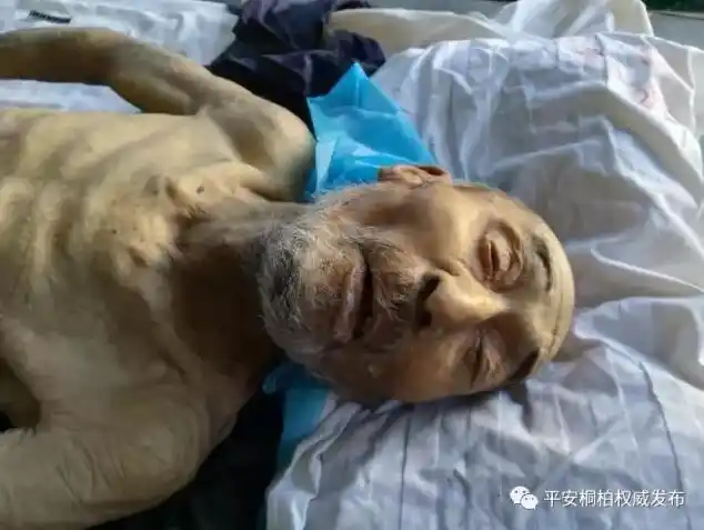 南阳一70岁左右乞讨者身亡皮包骨瘦身份难以确定